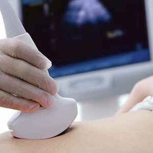 5. SSW: Ihre Schwangerschaftswoche | 5 semaines de grossesse | Nestlé BEBE Club 5. SSW: Ihre Schwangerschaftswoche | 5 semaines de grossesse | Nestlé BEBE Club